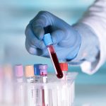 New Blood Test Simplifies Colon Cancer Screening, Improves Early Detection