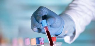 New Blood Test Simplifies Colon Cancer Screening, Improves Early Detection