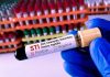 Gloved hand holding STI test tube labeled Negative