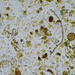 Microscopic image showing diverse microorganisms and particles.