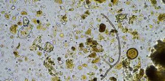 Python Parasite Found In Human Brain Microscopic image showing diverse microorganisms and particles.