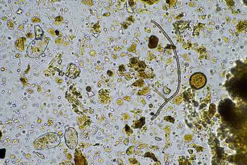 Microscopic image showing diverse microorganisms and particles.
